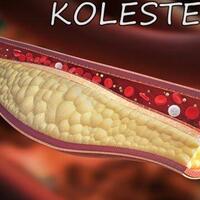 kolesterol-dan-efeknya-terhadap-pria-dan-wanita