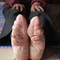 lotus-feet-kaki-cantik-budaya-china