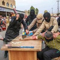 taliban-pastikan-hukuman-potong-tangan-kaki-akan-berlaku-lagi