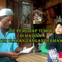 irt-pengidap-tumor-di-madina-butuh-uluran-tangan-dermawan