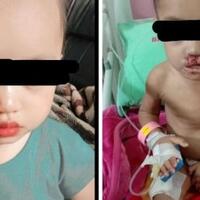 dianiaya-calon-ayah-sambung-bayi-di-kota-batu-terluka-disiram-air-panas