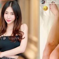 kasus-pencemaran-nama-baik-sean-anak-ahok-naik-penyidikan