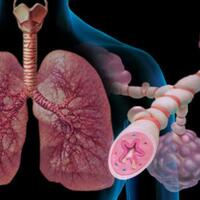 wah-ini-nih-4-jenis-olahraga-untuk-penderita-asma