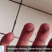 ngeri-korban-pencemaran-debu-batu-bara-di-marunda-anak-anak-dan-orang-tua-kena