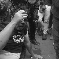 kondisi-ade-armando-setelah-keluar-dari-hcu-ada-masalah-kandung-kemih