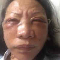 geger-driver-shopee-food-yg-ngaku-korban-begal-ternyata-hoaks-faktanya-begini