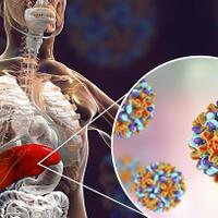 kasus-hepatitis-akut-di-indonesia-kemenkes-5-meninggal-10-dirawat