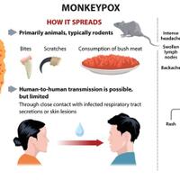 gawat-kalau-sampai-ke-indonesia-eropa--as-gelombang-infeksi-wabah-monkeypox
