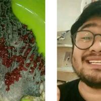 beredar-video-terdapat-banyak-cacing-merah-pada-babat-sapi-apakah-itu-berbahaya