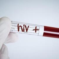 10-provinsi-di-ri-dengan-kasus-hiv-terbanyak-dki-nyaris-100-ribu