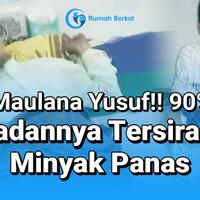 maulana-yusuf-90-badannya-tersiram-minyak-panas