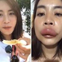 aksi-konyol-influencer-makan--tawon--bikin-bibirnya-bengkak-dan-akunnya-di-banned