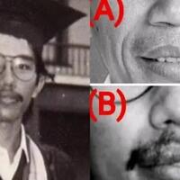 dokter-tifa-tuding-foto-saat-jokowi-wisuda-tak-mirip-secara-ilmu-anatomi