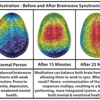 gambar-kondisi-otak-setelah-diterapi-binaural