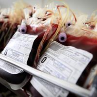 3-prosedur-operasi-yang-paling-membutuhkan-transfusi-darah