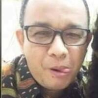 kepala-penis-seorang-bocah-terpotong-saat-ikut-sunat-massal-jadikan-ini-pelajaran