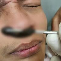 jagalah-kesehatan--hidung-warga-bogor-2-minggu-kemasukan-lintah-cuci-muka-di-sawah