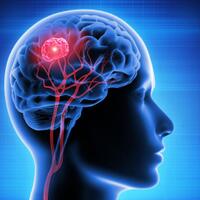 health-info-mengenal-5-jenis-tumor-otak-beserta-gejala-gejalanya