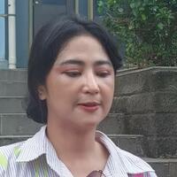 lakukan-transfer-lemak-wajah-dewi-perssik-berubah-begini-wajahnya-sekarang