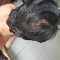 reborn-help-rambut-gua-rontok-hampir-botak---part-1