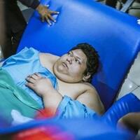 fajri-pemuda-obesitas-300-kg-meninggal-dunia-di-rscm