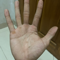 klinik-spiritual-baca-garis-tangan-dan-aura-gratis