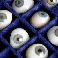 gw-pelupa-dan-kehilangan-mata