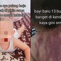 viral-bayi-dikerok-hingga-punggungnya-membiru-apakah-kerokan-itu-ada-manfaatnya