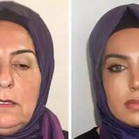 mengejutkan-foto-before-after-wanita-68-tahun-oplas-bikin-kaget-dikira-ibu-dan-anak