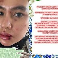 wajah-melepuh-dan-penuh-ruam-kartika-putri-disebut-kena-azab-apa-sebabnya