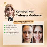 kembalikan-cahaya-mudamu-dengan-treatment-ini