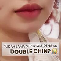 sudah-lama-struggle-dengan-double-chin-ini-solusinya