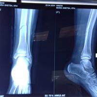 post-image