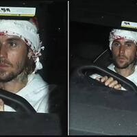 justin-bieber-terlihat-mengenakan-keffiyeh-netizen-dan-media-pro-israel-pun-mewek