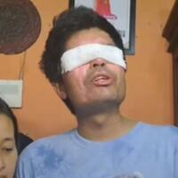 viral-pengakuan-mantan-rekan-kerja-agus-salim-korban-penyiraman-air-keras