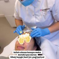 post-image