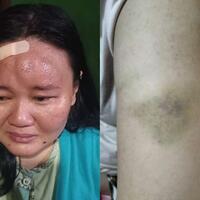 suami-ketahuan-telpon-perempuan-lain-istri-di-surabaya-alami-kdrt