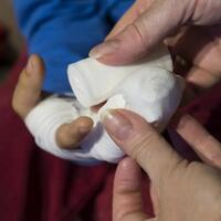 pria-di-turki-nyaris-kehilangan-lengan-digigit-pencuri-saat-coba-merampok-toko