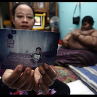 anak-paling-gemuk-di-dunia-ternyata-berasal-dari-indonesia