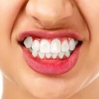 rahasia-dibalik-gigi-yang-berisik-pada-saat-tidur