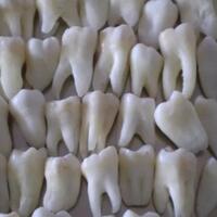 kelainan-gigi-hyperdontia-ini-bakal-bikin-kamu-merinding