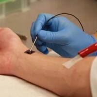 canggih-chip-seukuran-koin-yang-bisa-sembuhkan-luka