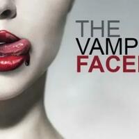 mengenal-vampire-facelift-perawatan-kulit-menggunakan-darah