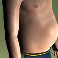 cacing-pita-28-meter-ditemukan-dari-perut-warga-simalungun