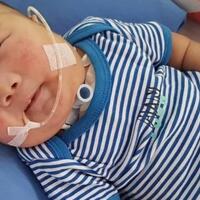 adam-fabumi-bayi-lucu-dengan-penyakit-langka-meninggal-dunia