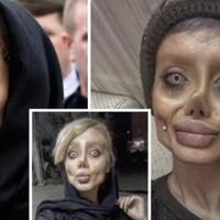 kabar-gadis-operasi-plastik-bak-angelina-jolie-ternyata-palsu