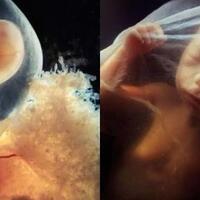 surrogacy-legalkah-di-indonesia