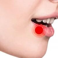 bahan-bahan-alami-berikut-ini-bisa-membantumu-mengobati-sariawan