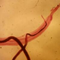 17-relawan-memasukkan-cacing-hidup-ke-tubuh-mereka