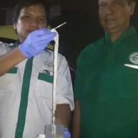di-simalungun-ada-cacing-pita-105-meter-di-tubuh-manusia-bagaimana-bisa